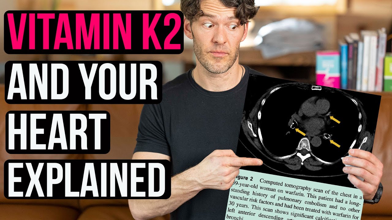 Vitamin K2, Heart Health & Arterial Calcification Must Know Details