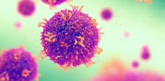 Arizona Measles Outbreak Spirals, Are You at Risk?