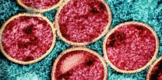 Monkeypox Smuggled into U.S.